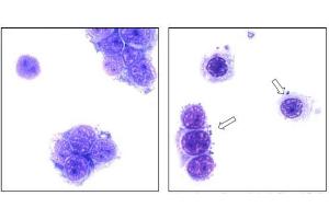 left: Mycoplasma negative Hep-2 cells tested by PHOENIXDX® MYCOPLASMA MIX (Giemsa staining).