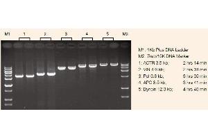 Image no. 3 for TransStart® FastPfu DNA Polymerase (ABIN5519528)